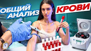 ЧТО ПОКАЗЫВАЕТ ОБЩИЙ АНАЛИЗ КРОВИ [upl. by Rovner]