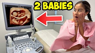 Ultrasound shows 2 BABIES   The Unicorn Family [upl. by Hanford798]