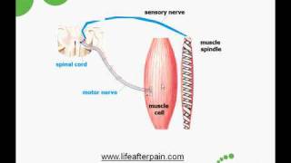 Myofascial Trigger Points Causes and Treatment [upl. by Oirelav]