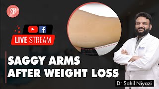 Saggy Arms After Weight Loss  Sagging Arm Treatment  Arm contouring  SB Aesthetics [upl. by Meijer]