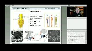 SPINE WEBINAR Miller Orthobullets review Webinars [upl. by Soilissav]