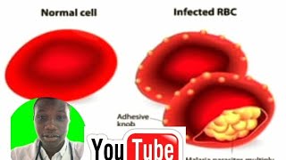 DRUGS USED TO TREAT MALARIA AND THEIR MODE OF ACTION ANTMARIALS AND EXAMPLES [upl. by Raye31]