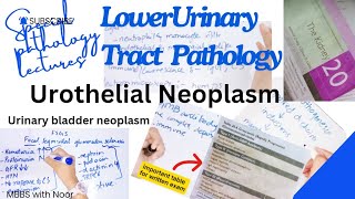 urothelial carcinoma  bladder neoplasm  lower urinary tract pathology  selflessmedicose [upl. by Jehoash]