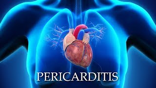 Pericarditis  Animation  Mind mapping EXTREME GRAPHIC [upl. by Solakcin135]