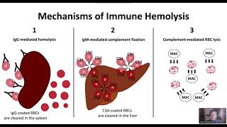 Autoimmune Hemolytic Anemia [upl. by Ecam]