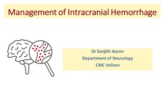 Management of Intracranial Hemorrhage [upl. by Ynnij443]