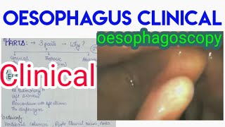 OESOPHAGUS clinical anatomy and vascular supply [upl. by Ateuqram]