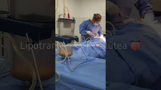 Lipotransferencia de grasa a glúteos Liposuccion Lipoescultura LipotransferenciaGlutea [upl. by Ettedualc]