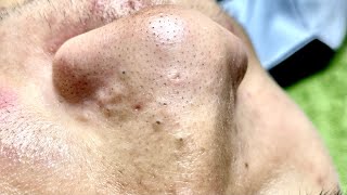 Satisfying video with Chung Vo Spa  339 [upl. by Sesilu]