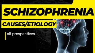 Etiology of Schizophrenia Causes of Schizophrenia UrduHindi wellnessbyfarah [upl. by Asikal250]