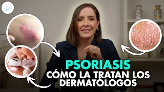 🔴 TRATAMIENTO para la PSORIASIS ¿Tiene CURA  Te lo EXPLICO TODO drapilarochoa  Dermatologa [upl. by Yeblehs]