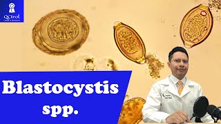 Conoce a Blastocystis spp Morfología y CLAVES para su identificación Laboratorio de parasitología [upl. by Ainafets]