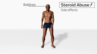 Side Effects of Steroids Abuse [upl. by Dnana]