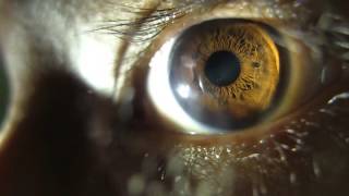 Pupil Dilating eye changing apeture HD [upl. by Lika]