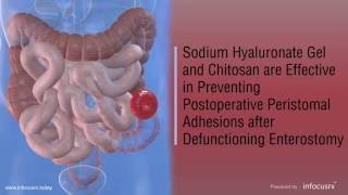 Postoperative Peristomal Adhesions decreased by the use of Sodium Hyaluronate Gel and Chitosan [upl. by Aksehcnarf]