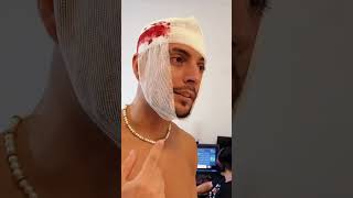 CORTE con NAVAJA SALE MAL🩸☠️ tiktok youtube memes shorts Coscu [upl. by Dahl]