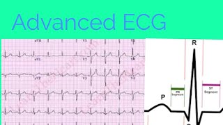 Electrocardiogram made easy Part Twomedicine classroomDr Bhupendra Shah [upl. by Mathur]