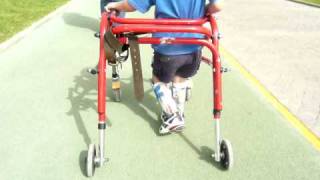 Tomas with cerebral palsy [upl. by Letha]