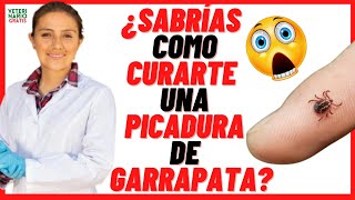 🔵 ¿CÓMO CURAR LA PICADURA DE GARRAPATA DE PERRO EN HUMANOS 🔵Síntomas y Tratamiento [upl. by Nylassej278]