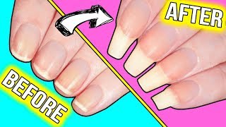 How to GROW YOUR NAILS FAST actually helpful information [upl. by Aicemak482]