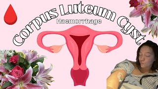 Daisy vs Ovarian Cyst amp Internal Bleeding  STORYTIME [upl. by Balthazar]