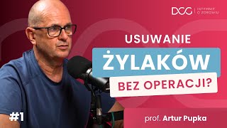 Usuwanie żylaków BEZ OPERACJI Wchodzisz i wychodzisz  Prof Pupka  Intymnie o Zdrowiu 1 [upl. by Auqinet]