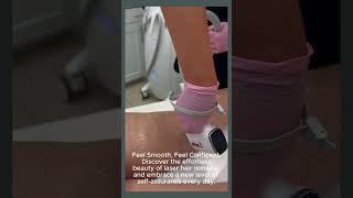 Laser Hair Removal MD Laser Clinic Burlingtonburlington laser hairremoval injectables [upl. by Githens198]