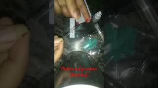 How to test malaria through malarial kit💉malarialtestprocedurebloodtest medicallife [upl. by Nynahs]