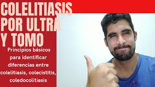 Colelitiasis y colecistitis diferencias clínicas y por ultrasonido [upl. by Trebliw]