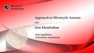 Approach To Microcytic Anemia [upl. by Alyakcm]