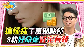 這種痣 千萬別點掉 3款好命痣 註定有錢 ft謝凱蒂 簡少年【 小宇宙大爆發 】 [upl. by Nairbo]