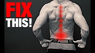 How to Fix a Bulging Disc NO SURGERY [upl. by Killigrew80]