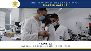 Inyección de Cerámicas de Litio emax press para carillas  Máster Diseño CAD y Cerámica Dental [upl. by Stubstad]