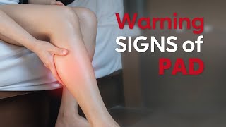 The Signs of Peripheral Artery Disease You Need to Know [upl. by Jereld520]