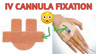 IV Cannula Fixation  IV Cannula Fixator Uses  How To Apply IV Cannula Fixator cannula Fixator [upl. by Auqenehs]