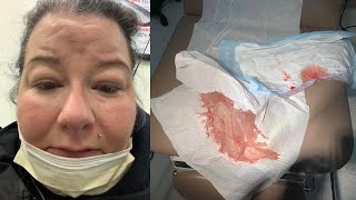 BARTHOLIN’S CYST REMOVAL amp RECOVERY  MOST PAIN EVER part 1 [upl. by Nnylyoj]