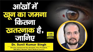 Dr Sunil Kumar Singh से जानिए आंखों में खून का जमना कितना गंभीर हो सकता है क्या है उपाय [upl. by Atal226]