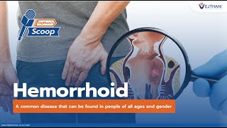 Hemorrhoid a common disease that can be found in people of all ages and gender  Vejthanis Scoop [upl. by Newfeld]