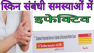 Clobenate  GM cream Uses and side effects in Hindi  क्लोबिनेट जी एम क्रीम की जानकारी [upl. by Felske804]