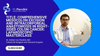 Comprehensive Mesocolon Excision and Intracorporeal Anastomosis in Right Sided Colon Cancer [upl. by Cassady]