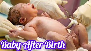 Newborn baby First 5 minutes After Birth  Baby immediately After c section birth care [upl. by Haldan14]