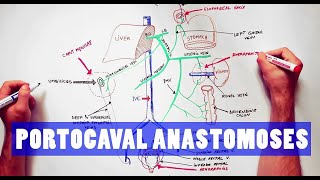 Portocaval Anastomoses  ANATOMY Tutorial [upl. by Lamek930]