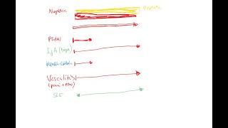 Nephrology 14b recap of nephroticnephritic spectrum SLE PSGN IgA vasculitis amyloidosis DM [upl. by Zita]