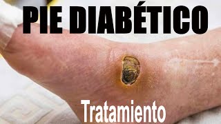 TERRIBLE PIE DIABÉTICO 🦶 CUIDADOS Y TRATAMIENTO 👏 DR IVAN GUTIÉRREZ CIRUJANO VASCULAR  FLEBOCENTER [upl. by Rebmac]