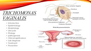 Trichomonas vaginalis [upl. by Thurlough]