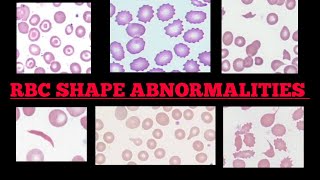 RBC Shape Abnormalities In Peripheral 🩸Blood Smear  Made Easy  Images [upl. by Reace120]