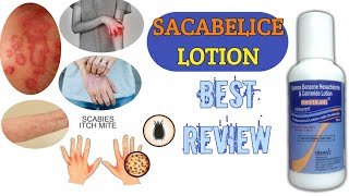 Scabelice Lotion Uses  Scabies Khujli Scabicide  Gamma Benzene Hexachloride amp Cetrimide [upl. by Launame]