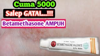 Review salep gatal Betamethasone valerate [upl. by Tiena]