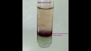 Molisch Testa group test for Carbohydrates [upl. by Enilreug]