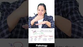 1 minute learning  Rheumatic fever  Pathogenesis [upl. by Haram996]